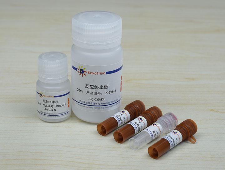 抗氟离子酸性磷酸酶检测试剂盒